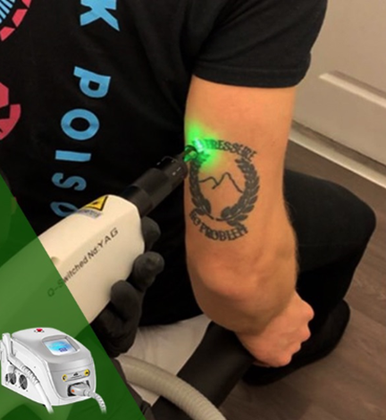 QS laser equipment 2 QS-Laserausrüstung 2