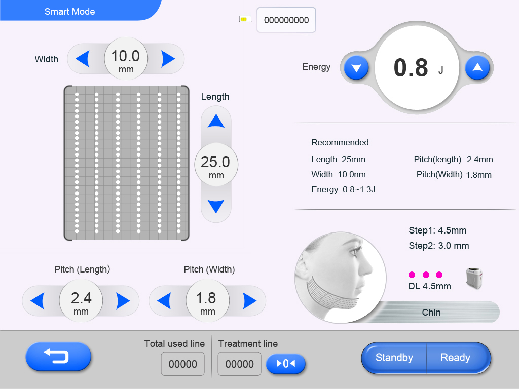 hifu screen HIFU-Bildschirm