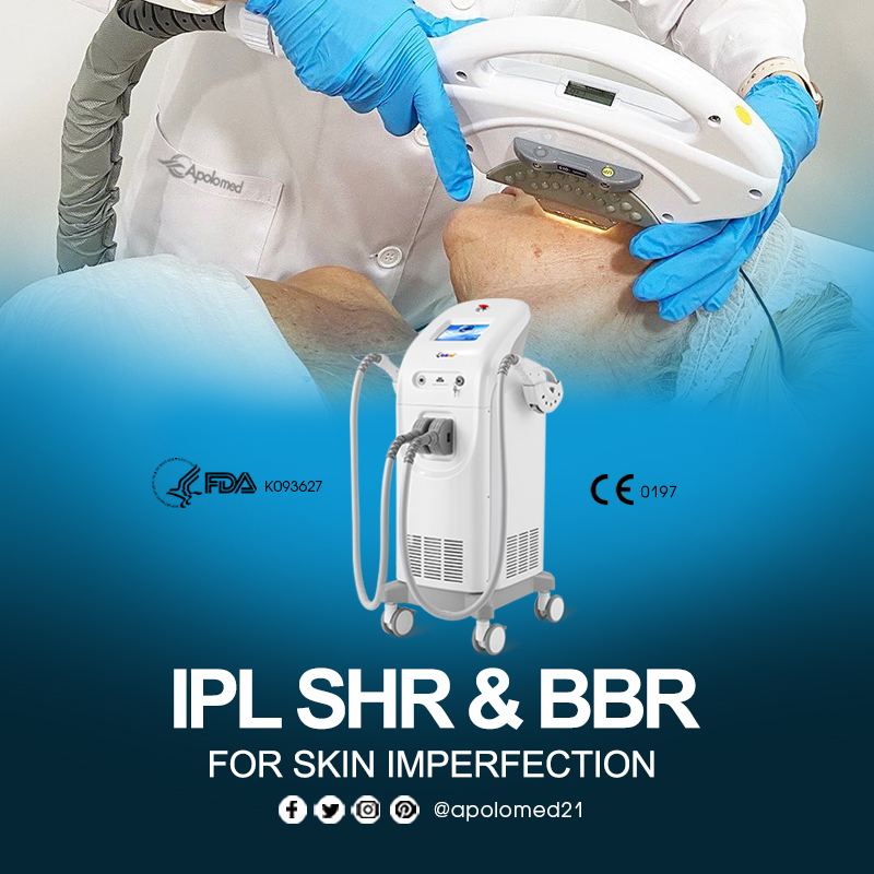 IPL SHR-Technologie 660 3.9