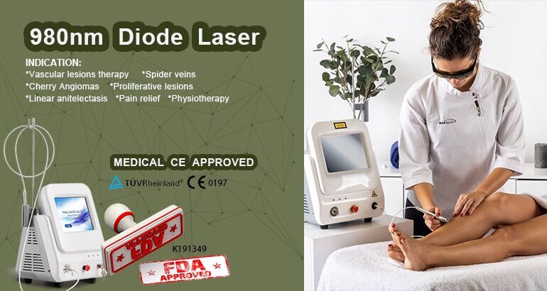 980-nm-Diodenlaser-Ger&auml;t zur Gef&auml;&szlig;entfernung