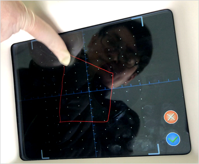 C02-Laserbildschirm 5