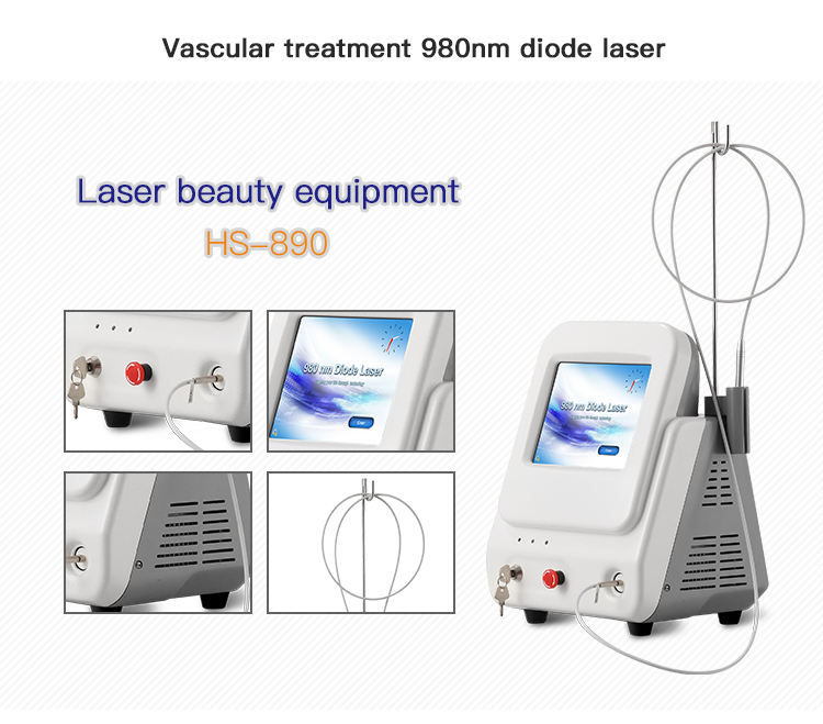 980-nm-Diodenlaser f&uuml;r Besenreiser-Entfernungsger&auml;t