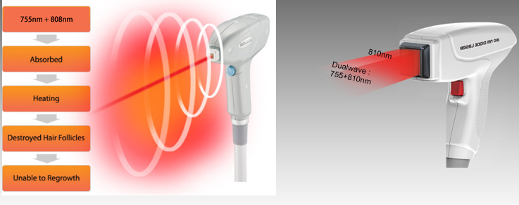 Diodenlaserausr&uuml;stung