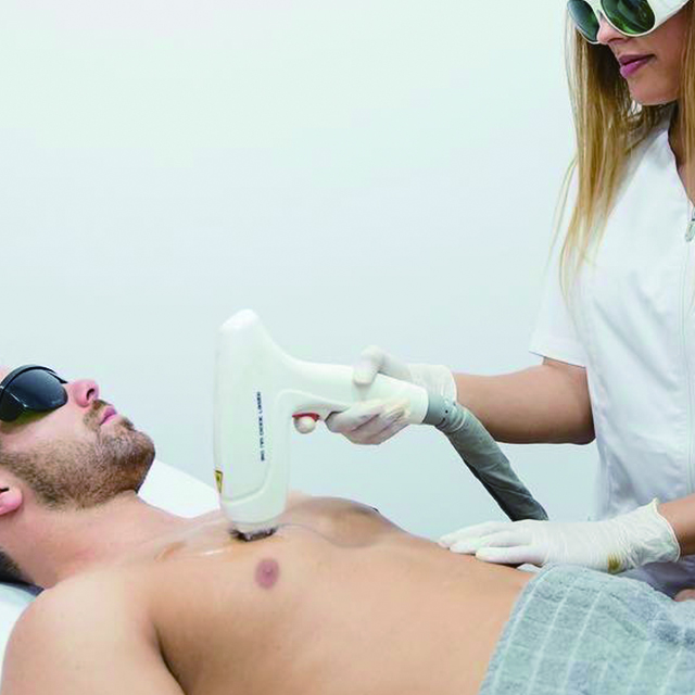 Haarentfernung Laser