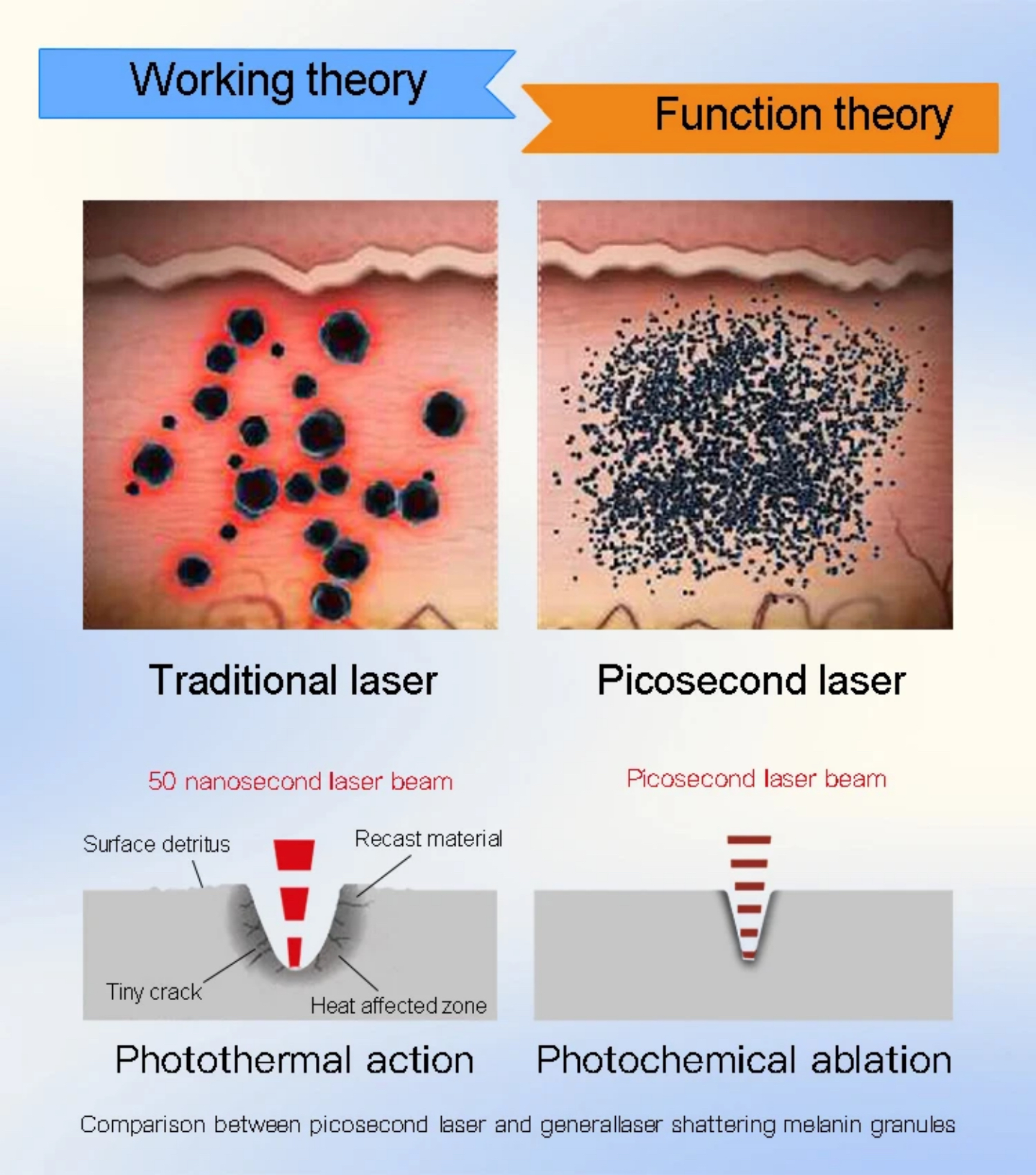 Was ist die Wissenschaft hinter der Entfernung von Laser -Tattoo?